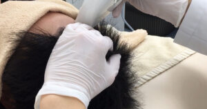 ミノキジェットプラス