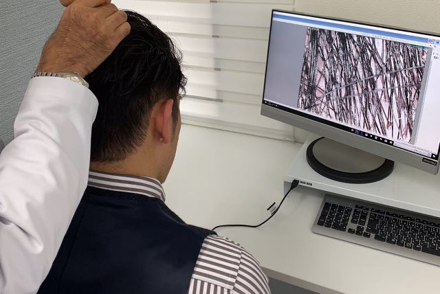 薄毛にお悩みの方々の心境